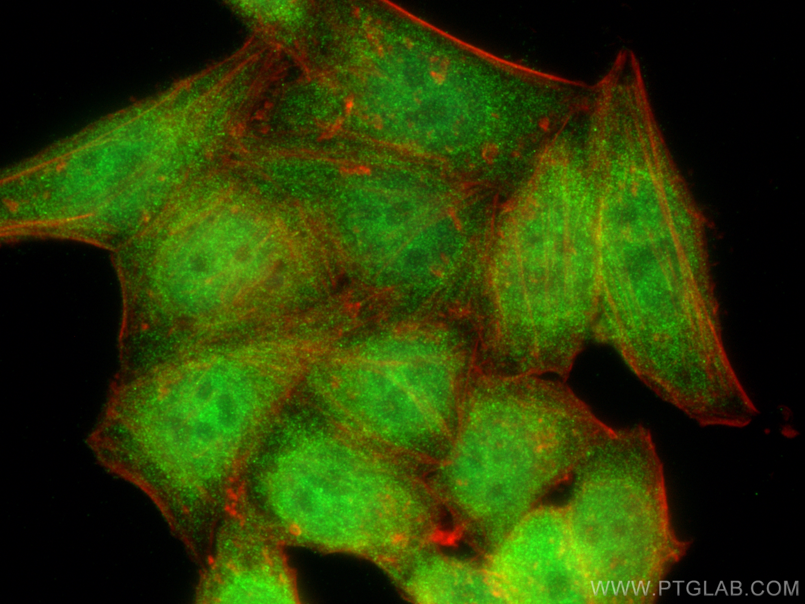 IF Staining of HepG2 using 22503-1-AP