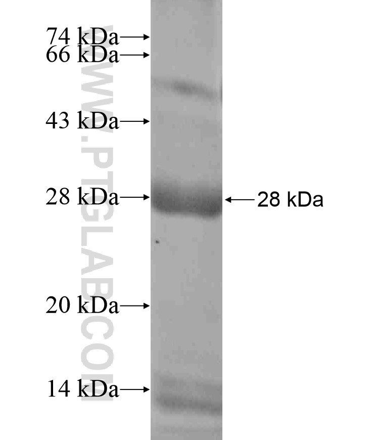 RQCD1 fusion protein Ag18507 SDS-PAGE RQCD1 fusion protein Ag18507 SDS-PAGE