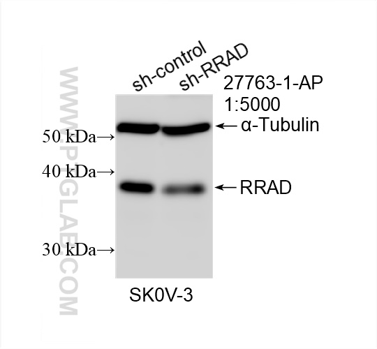 WB analysis of SKOV-3 using 27763-1-AP