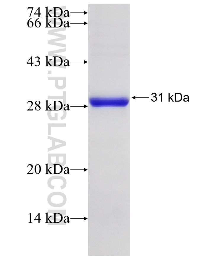 RRAGA fusion protein Ag25872 SDS-PAGE RRAGA fusion protein Ag25872 SDS-PAGE