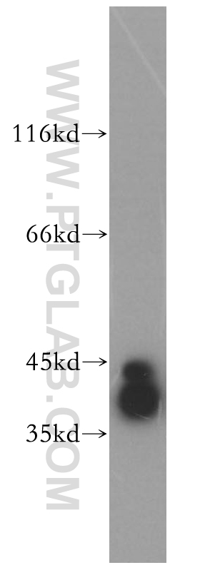 RRAGB