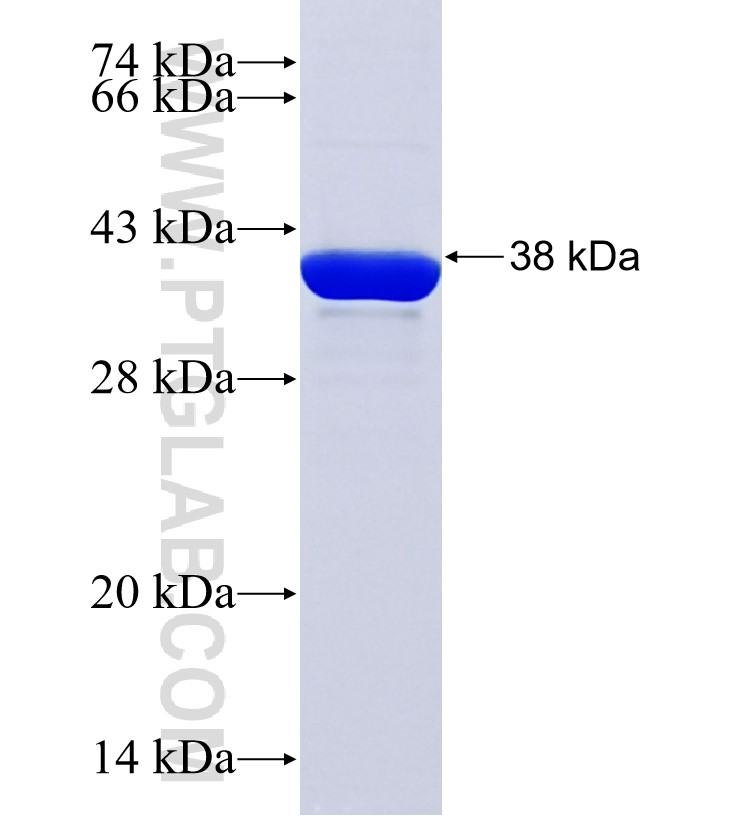 RRAGC fusion protein Ag25780 SDS-PAGE