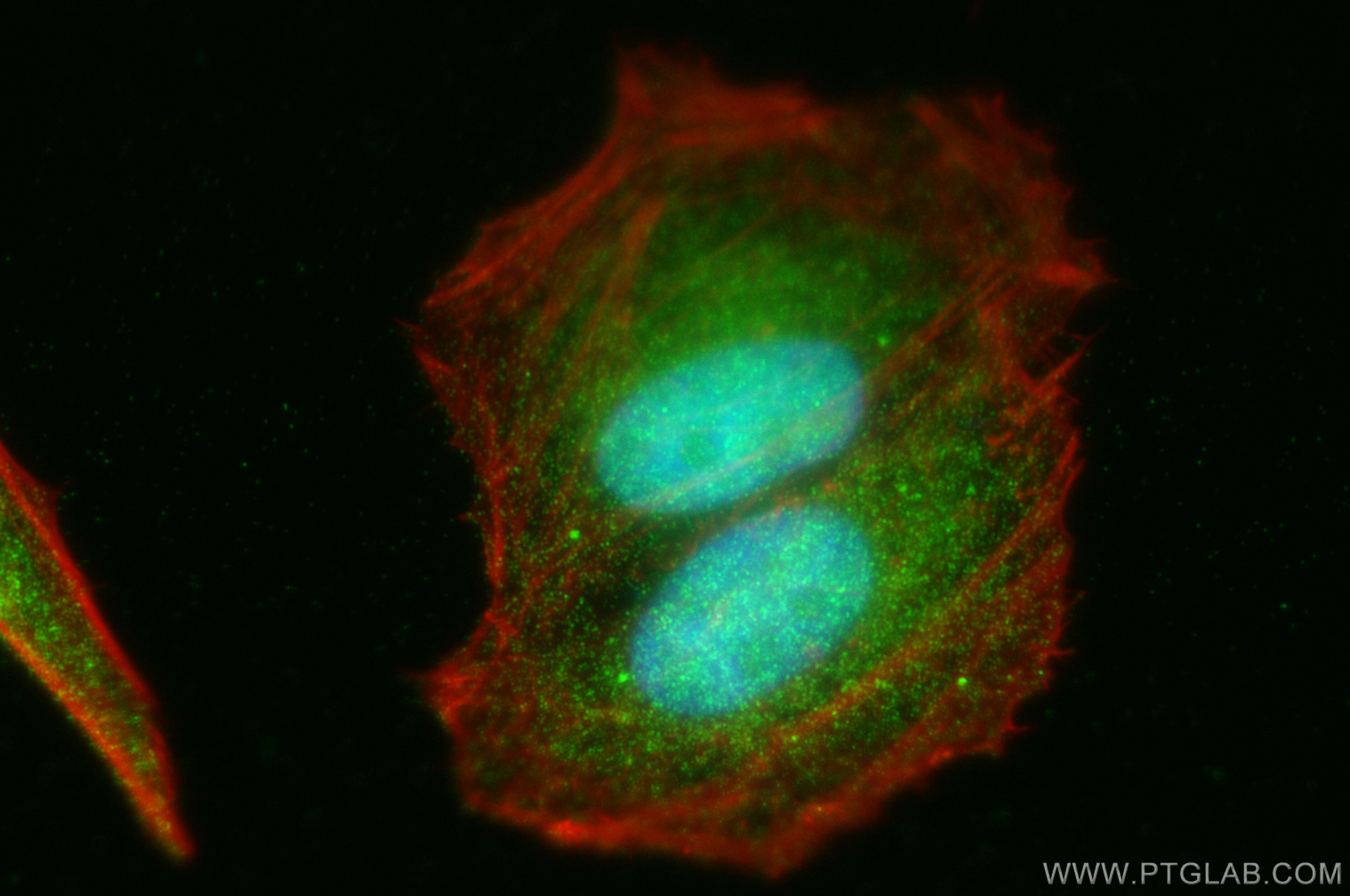 IF Staining of HepG2 using 15315-1-AP