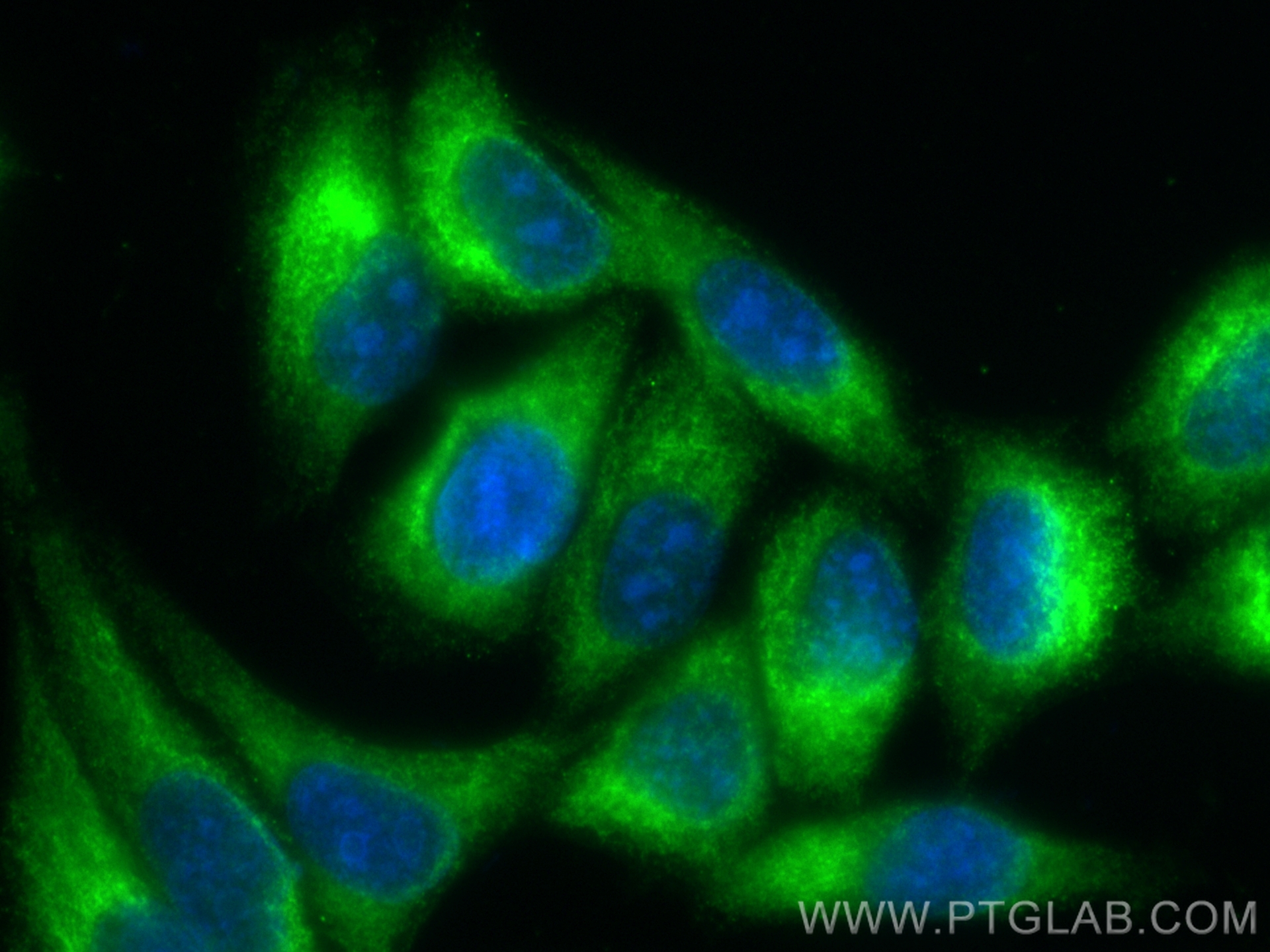 IF Staining of HepG2 using CL488-82890-3