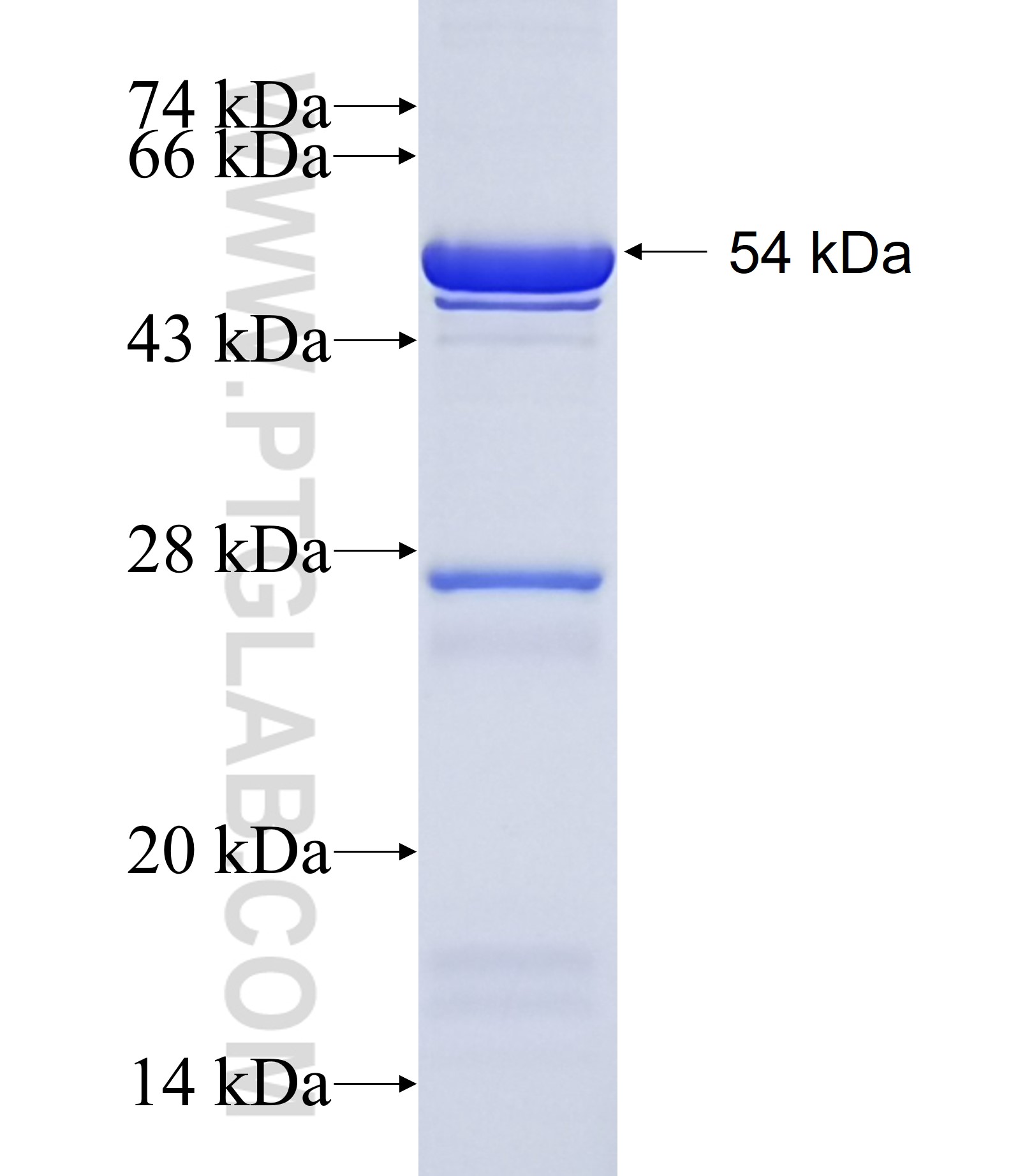 RRBP1 fusion protein Ag17431 SDS-PAGE