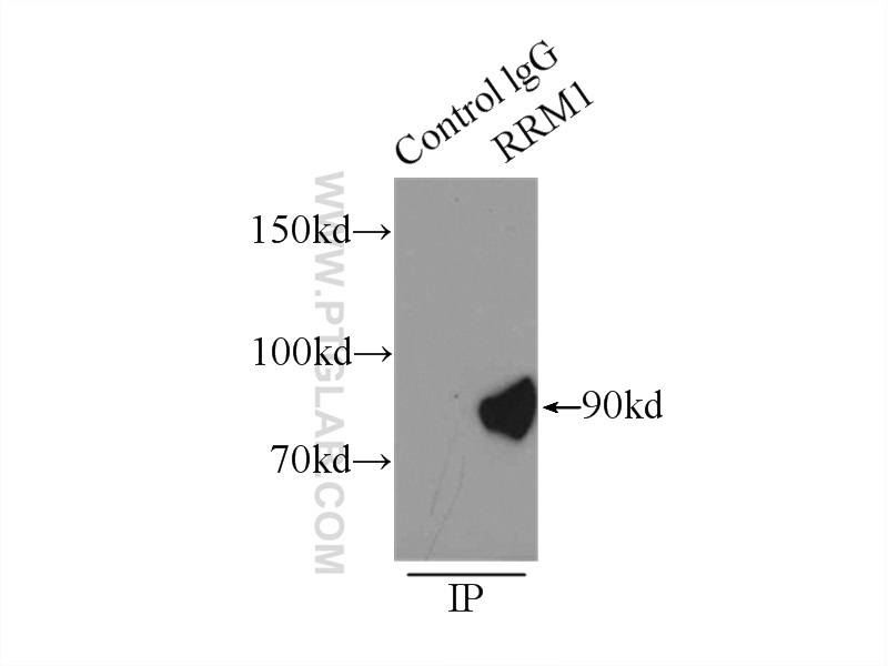 IP experiment of K-562 using 10526-1-AP