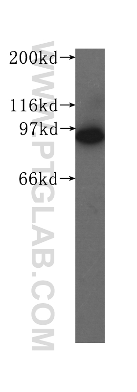 WB analysis of K-562 using 60073-1-Ig