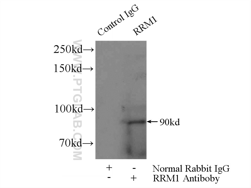 IP experiment of K-562 using 60073-2-Ig