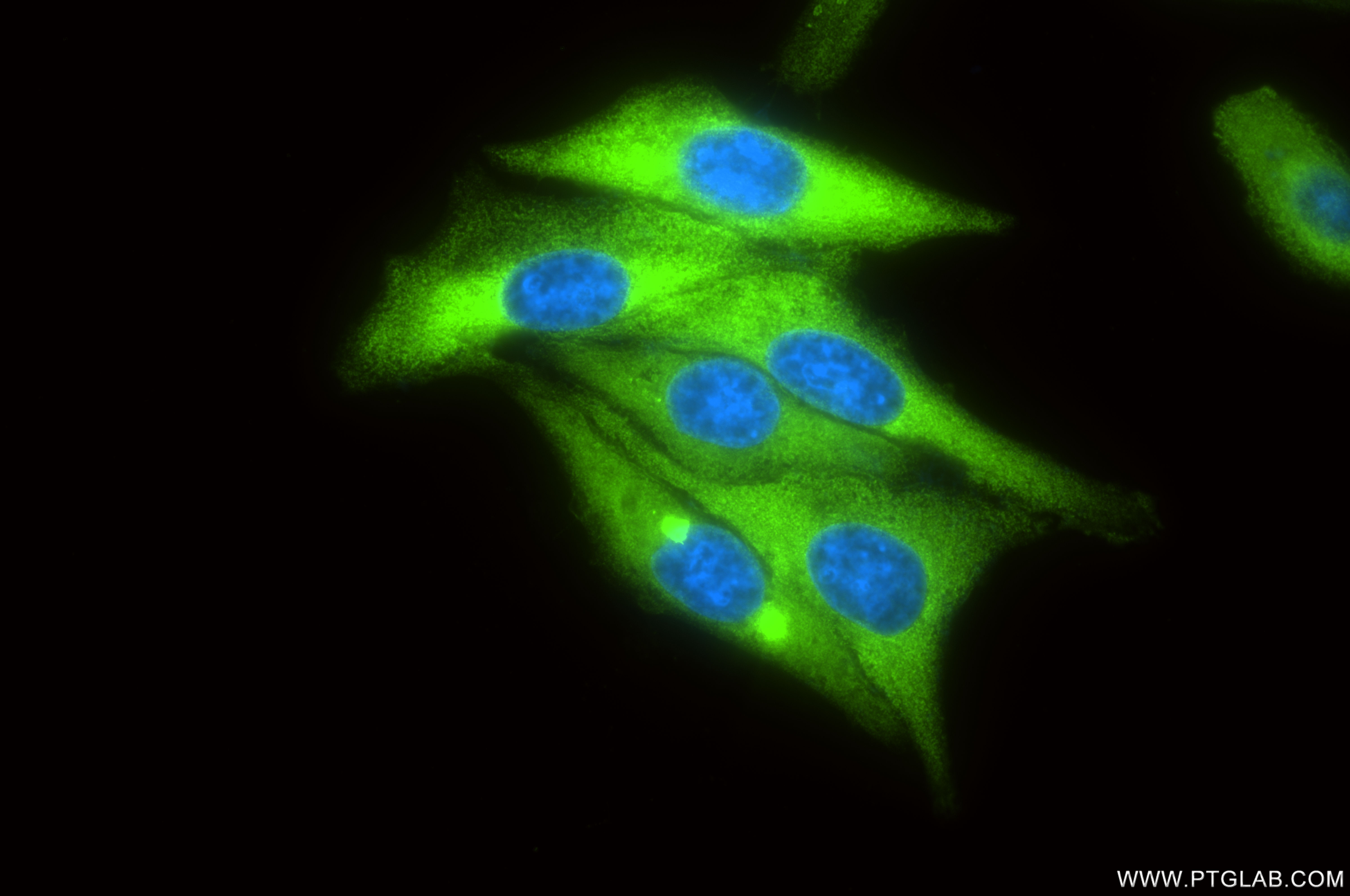 IF Staining of HeLa using 86135-1-RR (same clone as 86135-1-PBS)