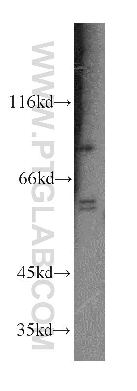 RRM1-Specific