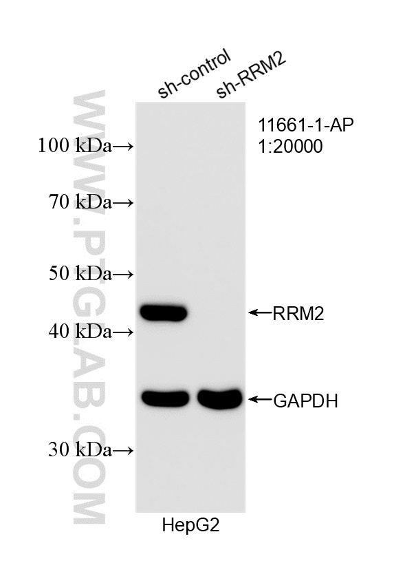 WB analysis of HepG2 using 11661-1-AP WB analysis of HepG2 using 11661-1-AP