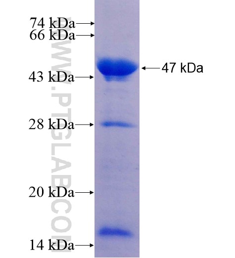 RRM2B,p53R2 fusion protein Ag12483 SDS-PAGE RRM2B,p53R2 fusion protein Ag12483 SDS-PAGE