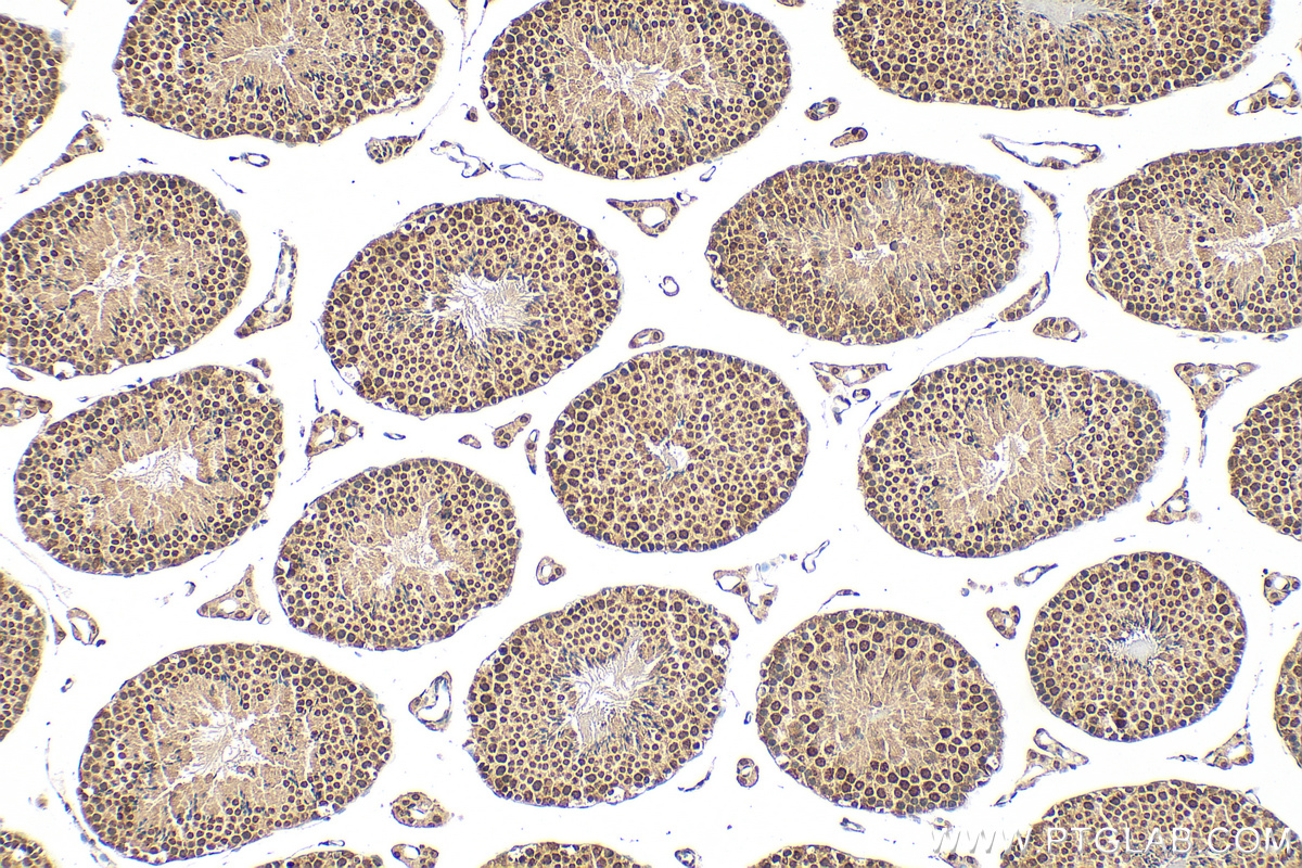 IHC staining of mouse testis using 25918-1-AP