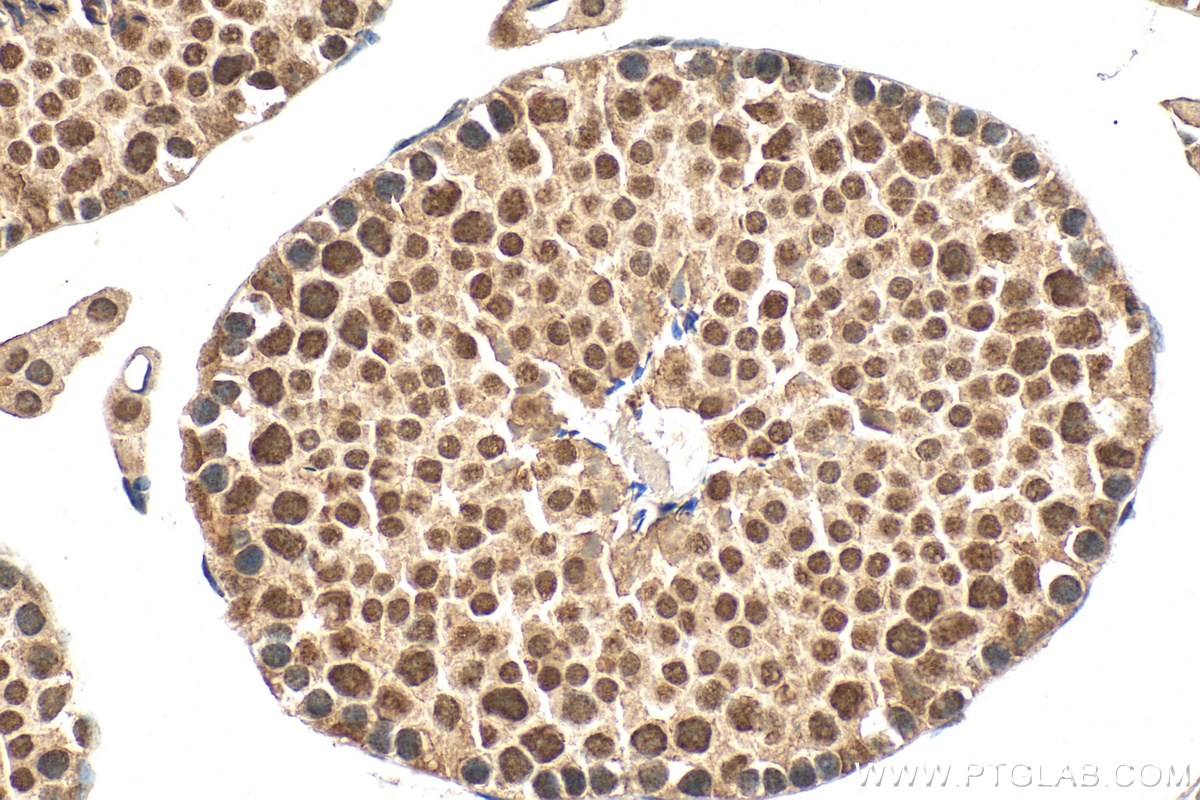 IHC staining of mouse testis using 25918-1-AP