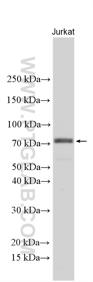 Various lysates were subjected to SDS PAGE followed by western blot with 25918-1-AP (RRN3 antibody) at dilution of 1:2000 incubated at room temperature for 1.5 hours. WB analysis using 25918-1-AP