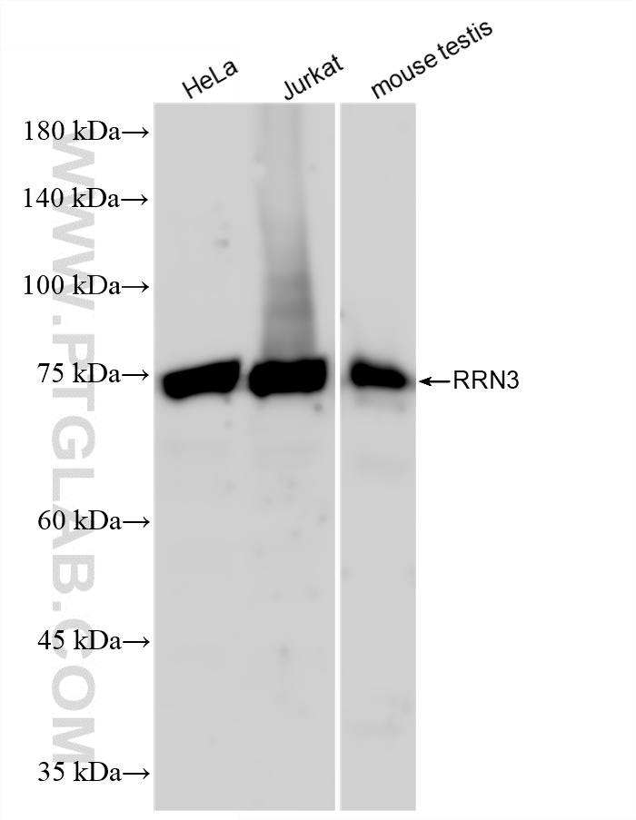 WB analysis using 87046-1-RR