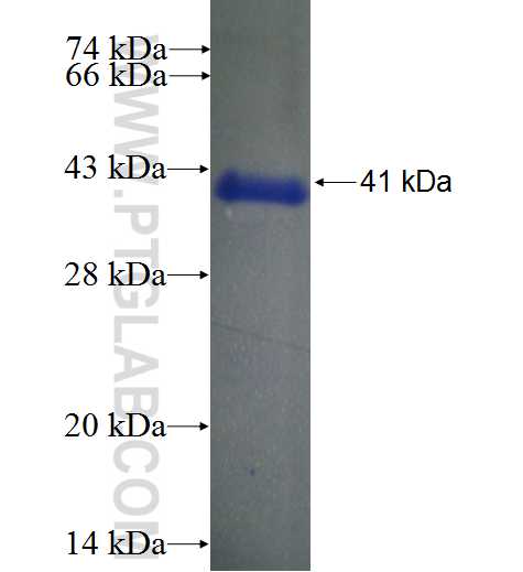 RRN3 fusion protein Ag23207 SDS-PAGE