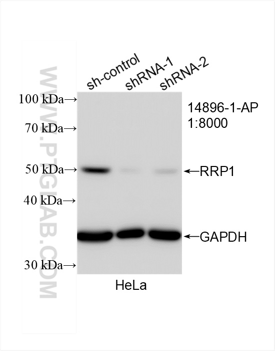 WB analysis of HeLa using 14896-1-AP