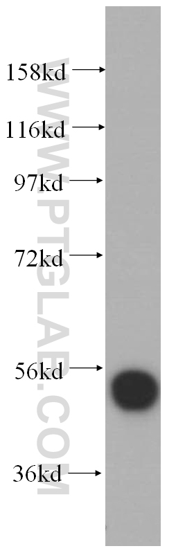 WB analysis of HEK-293 using 14896-1-AP