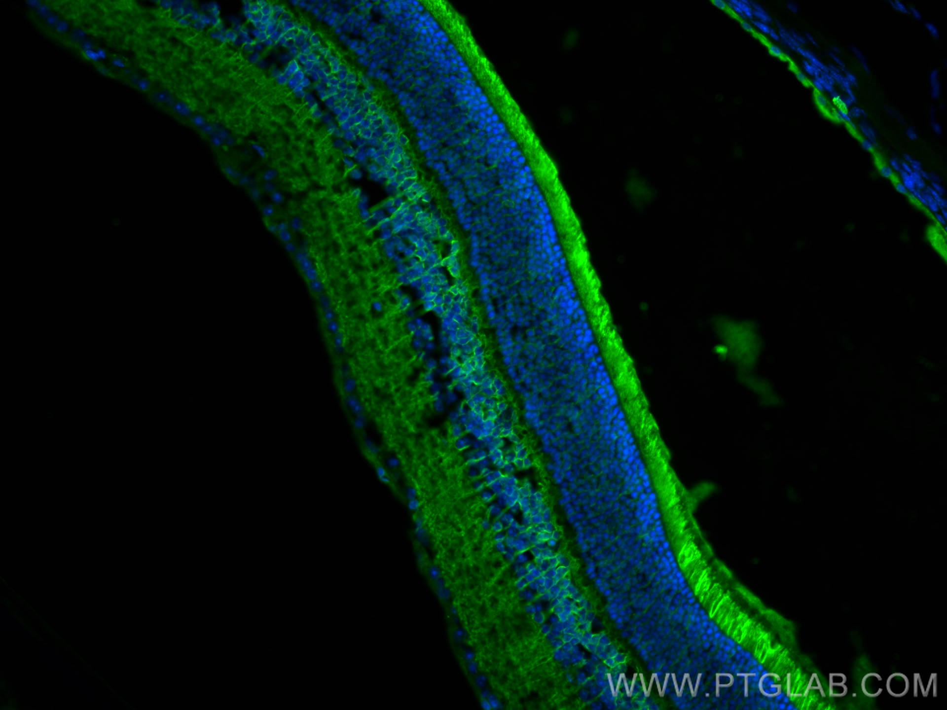 IF Staining of mouse eye using 24430-1-AP