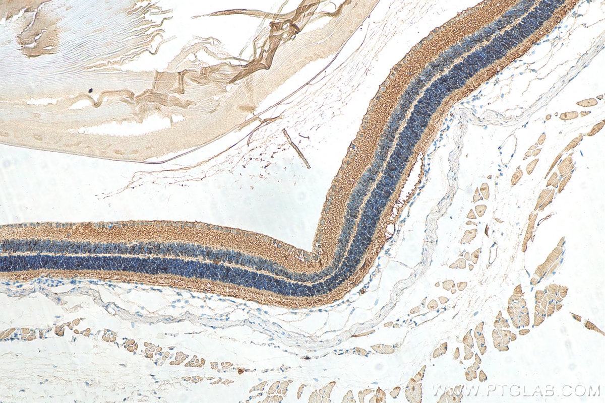 IHC staining of mouse eye using 24430-1-AP