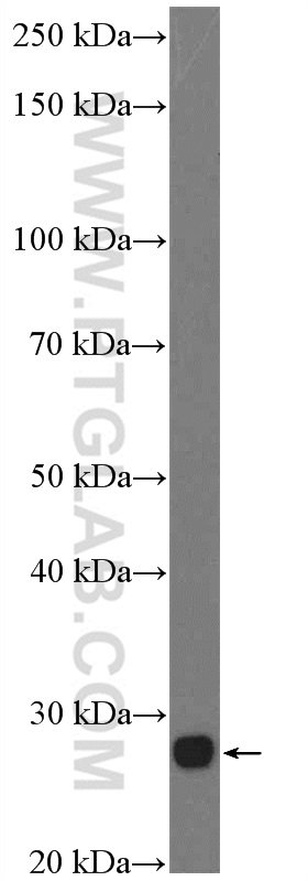 WB analysis of mouse eye using 24430-1-AP