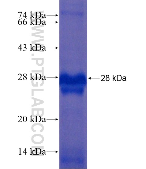 RS1 fusion protein Ag18885 SDS-PAGE
