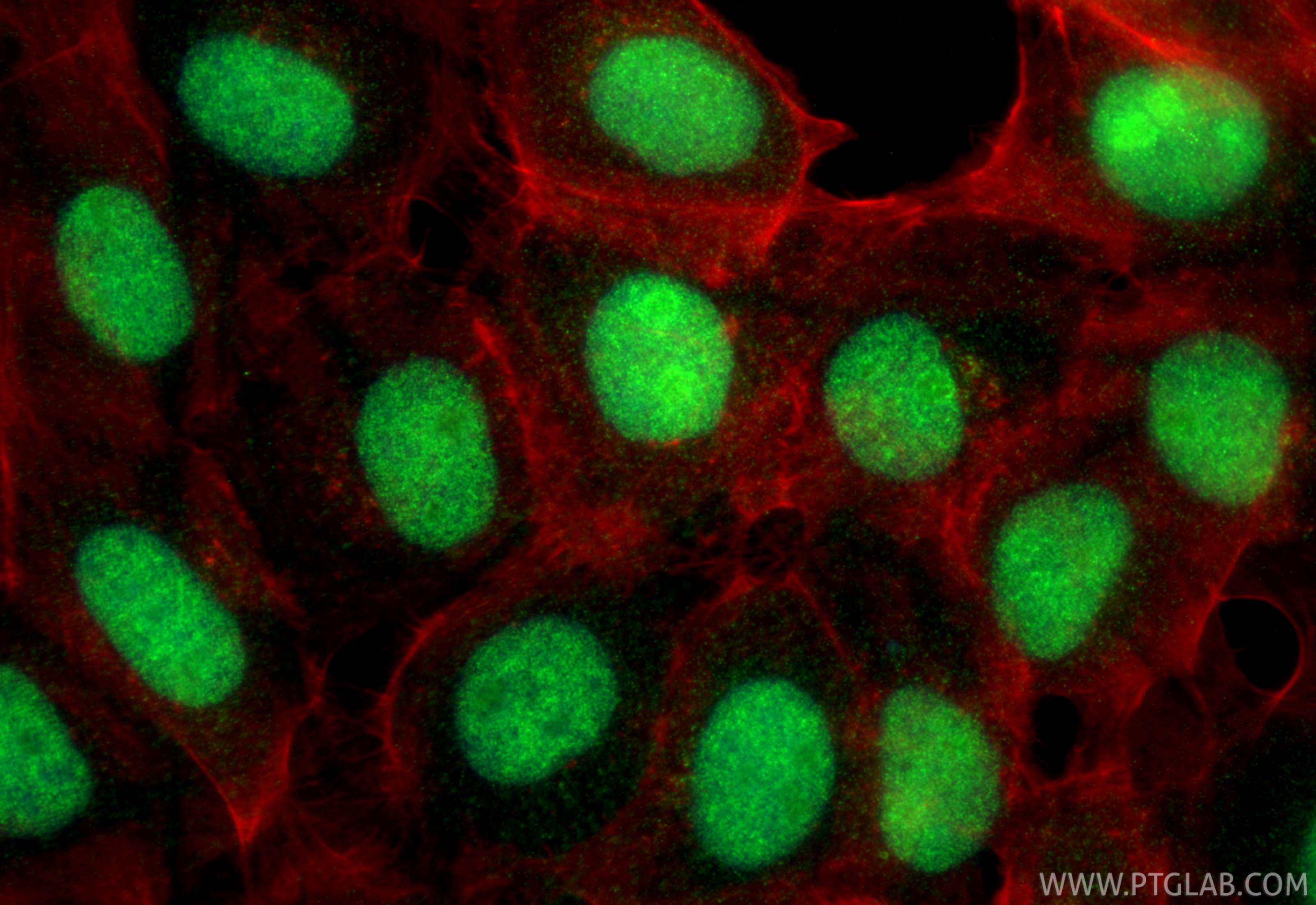IF Staining of A431 using 24734-1-AP (same clone as 24734-1-PBS) IF Staining of A431 using 24734-1-AP (same clone as 24734-1-PBS)