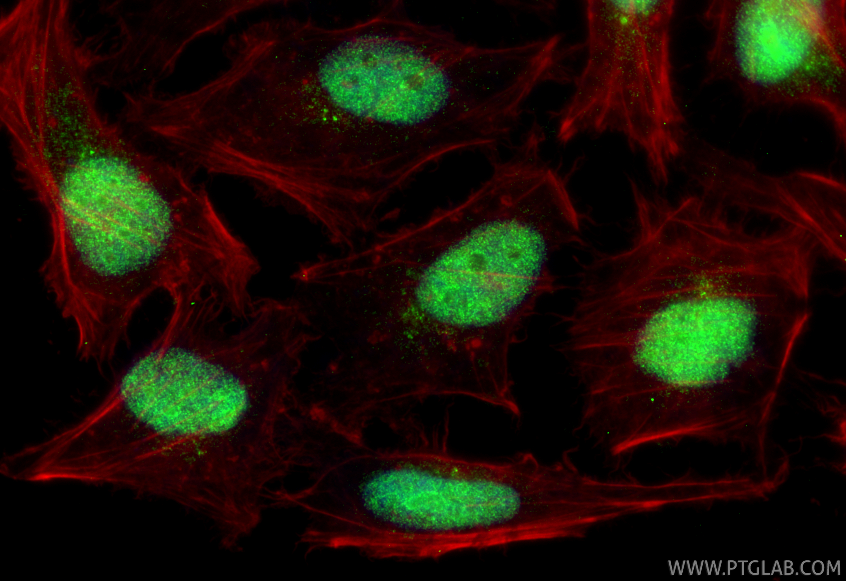 IF Staining of HeLa using 24734-1-AP (same clone as 24734-1-PBS) IF Staining of HeLa using 24734-1-AP (same clone as 24734-1-PBS)