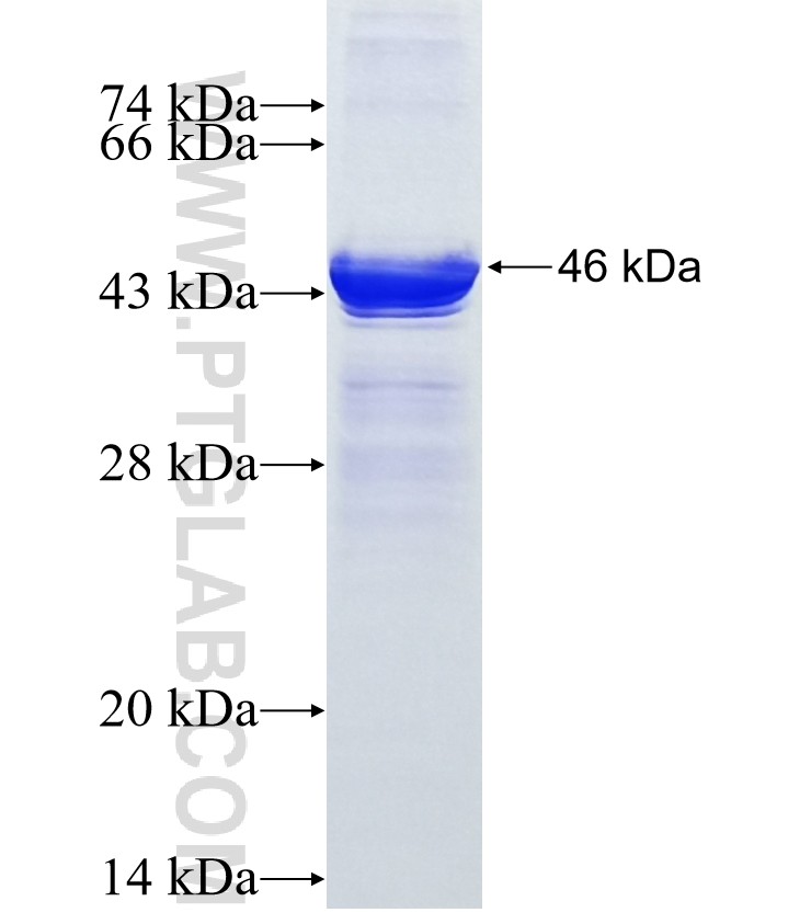 RSBN1L fusion protein Ag11482 SDS-PAGE