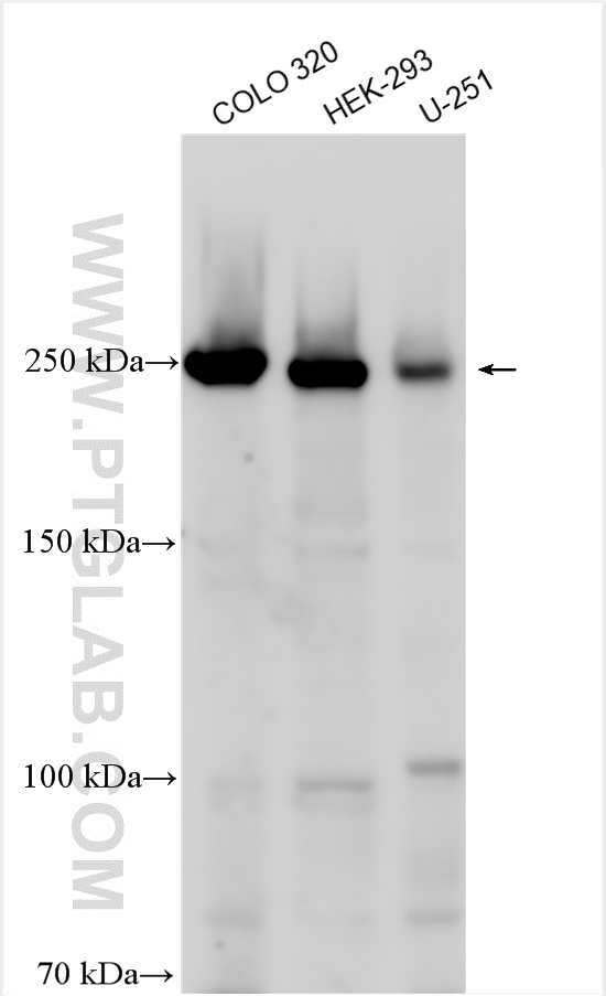 WB analysis using 26011-1-AP (same clone as 26011-1-PBS)