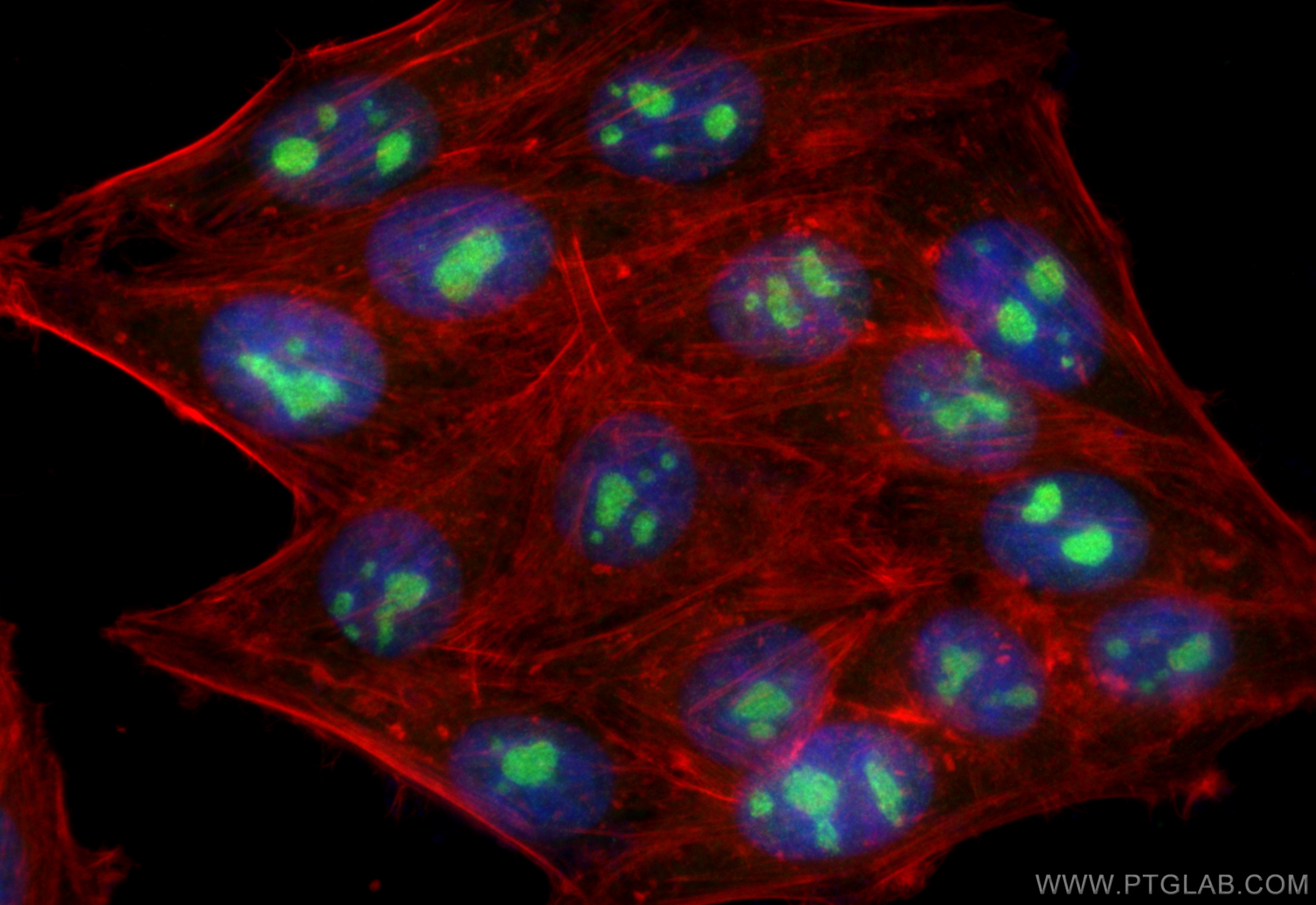 IF Staining of HepG2 using 25190-1-AP