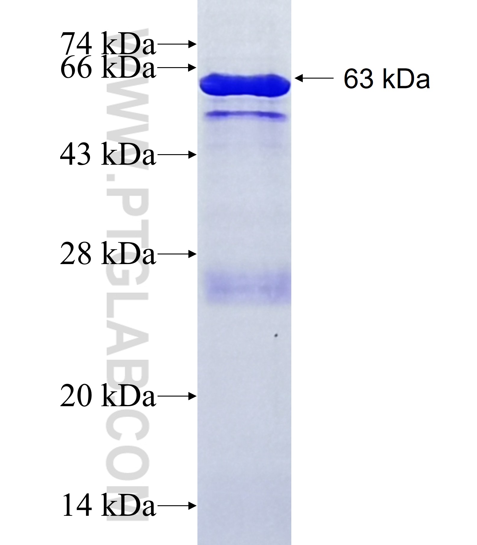 RSPH10B fusion protein Ag10877 SDS-PAGE RSPH10B fusion protein Ag10877 SDS-PAGE