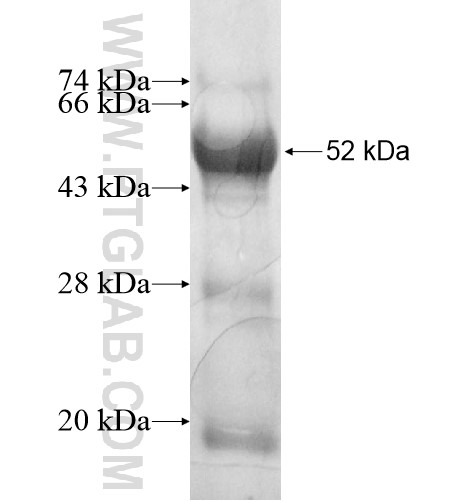 RSPH3 fusion protein Ag11958 SDS-PAGE RSPH3 fusion protein Ag11958 SDS-PAGE