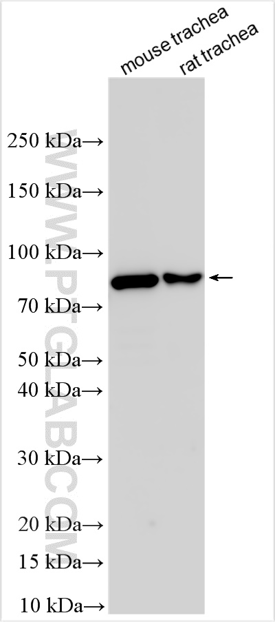 RSPH4A