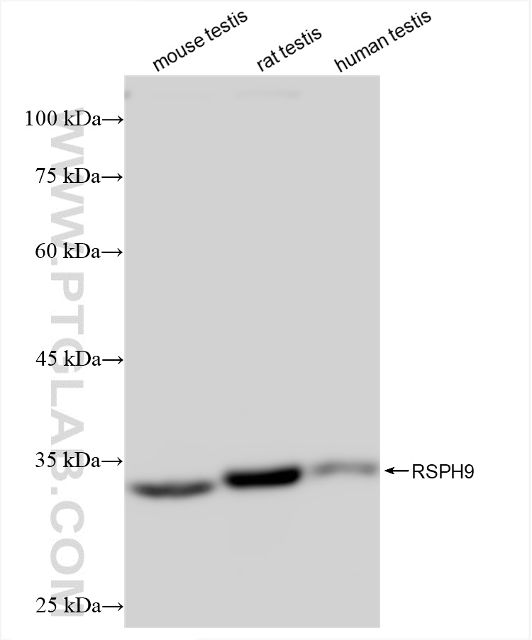 WB analysis using 85026-4-RR