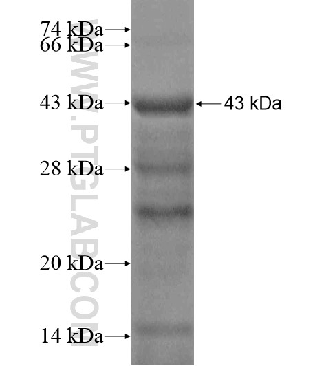 RSPH9 fusion protein Ag19752 SDS-PAGE RSPH9 fusion protein Ag19752 SDS-PAGE