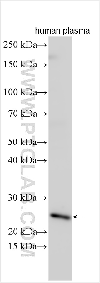 WB analysis of human plasma using 25348-1-AP