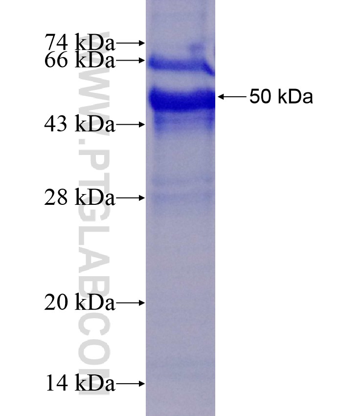 RSPO2 fusion protein Ag11041 SDS-PAGE RSPO2 fusion protein Ag11041 SDS-PAGE