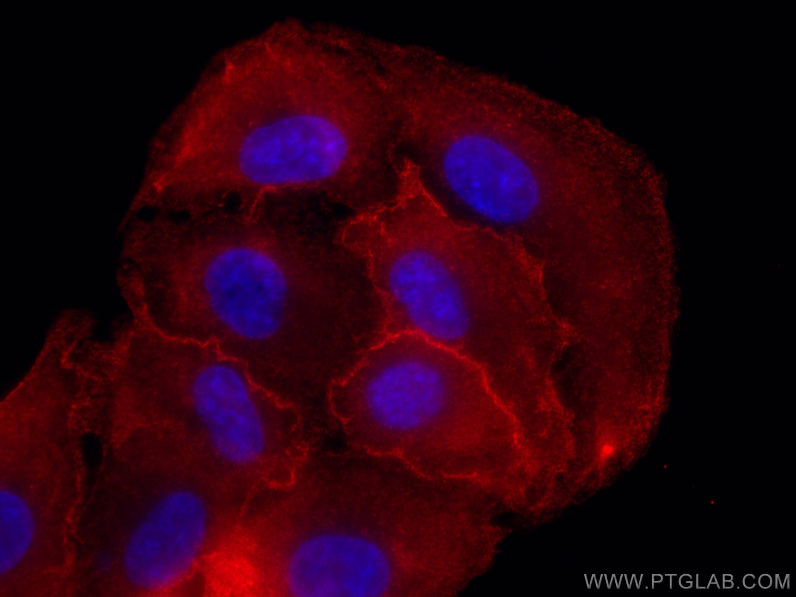 IF Staining of A549 using 66314-1-Ig (same clone as 66314-1-PBS)