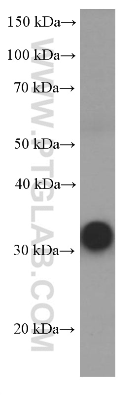 WB analysis of human skeletal muscle using 66314-1-Ig (same clone as 66314-1-PBS)