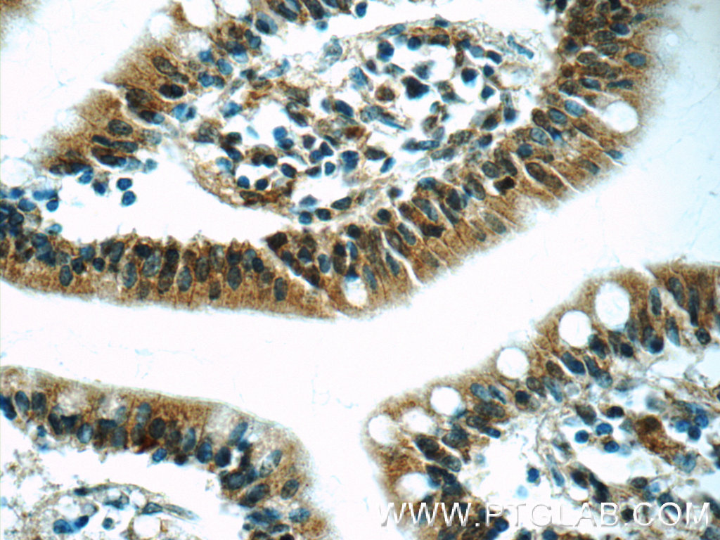 IHC staining of human small intestine using 23826-1-AP