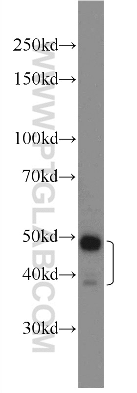 WB analysis of HeLa using 23826-1-AP