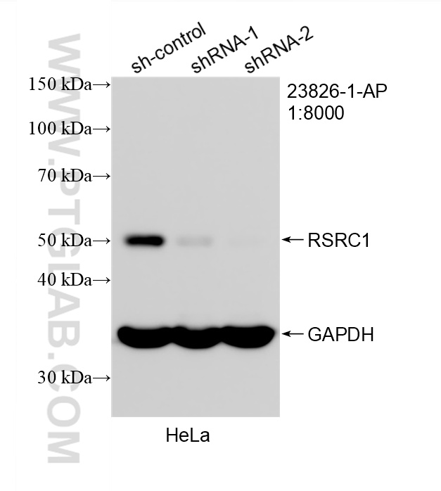 WB analysis of HeLa using 23826-1-AP WB analysis of HeLa using 23826-1-AP