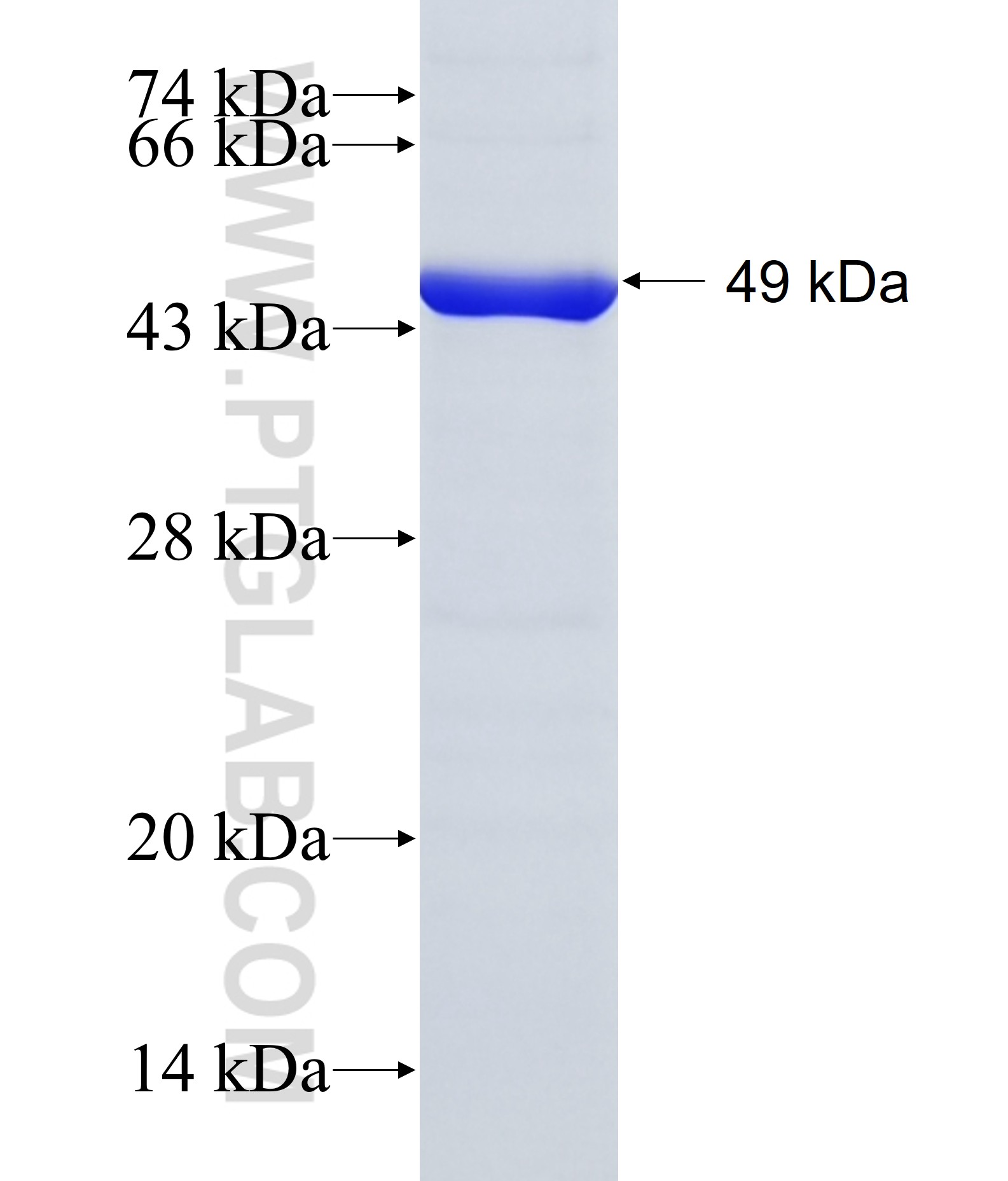 RTCD1 fusion protein Ag9304 SDS-PAGE