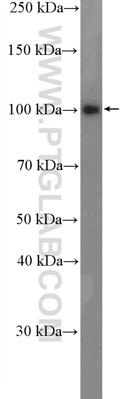 WB analysis of MCF-7 using 12170-1-AP