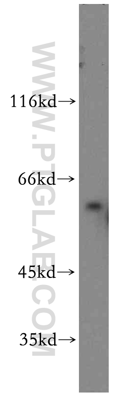 WB analysis of A431 using 12762-1-AP