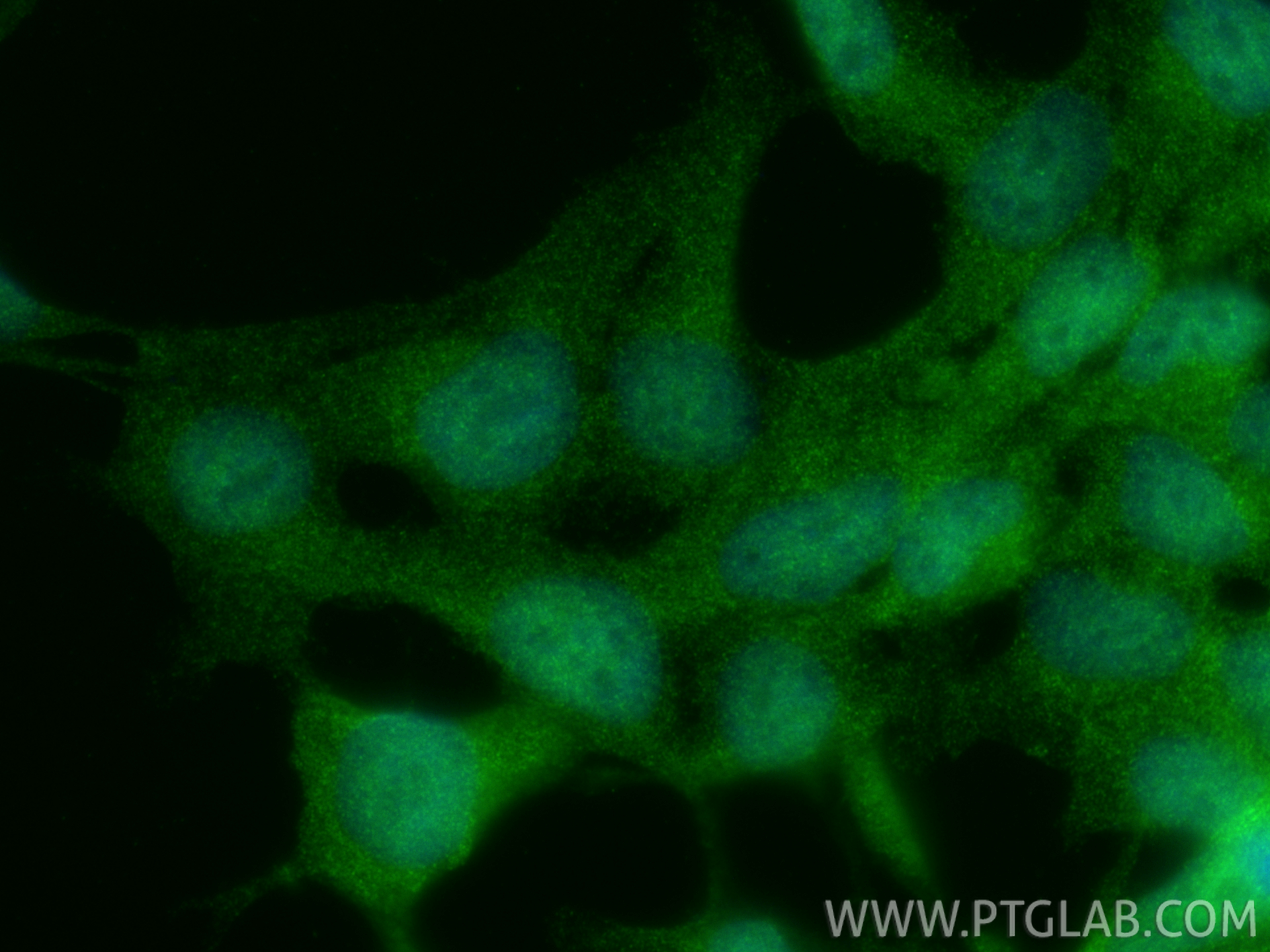 Immunofluorescent analysis of (4% PFA) fixed HEK-293 cells using RTKN2 antibody (17458-1-AP) at dilution of 1:200 and CoraLite®488-Conjugated Goat Anti-Rabbit IgG(H+L) (<a class='green' href='/productredirect?CatalogNo=SA00013-2' target='_blank'>SA00013-2</a>). IF Staining of HEK-293 using 17458-1-AP