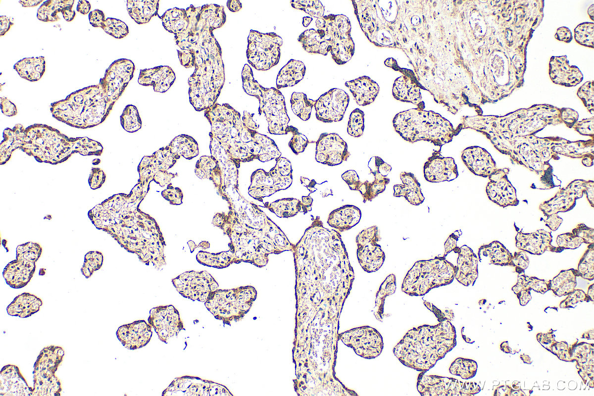 Immunohistochemical analysis of paraffin-embedded human placenta tissue slide using 17458-1-AP (RTKN2 antibody) at dilution of 1:200 (under 10x lens). Heat mediated antigen retrieval with Tris-EDTA buffer (pH 9.0). IHC staining of human placenta using 17458-1-AP