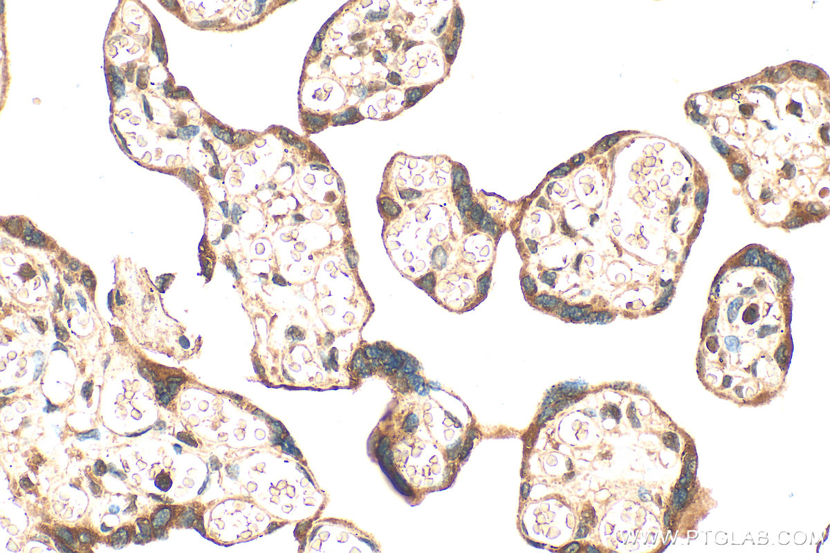 Immunohistochemical analysis of paraffin-embedded human placenta tissue slide using 17458-1-AP (RTKN2 antibody) at dilution of 1:200 (under 40x lens). Heat mediated antigen retrieval with Tris-EDTA buffer (pH 9.0). IHC staining of human placenta using 17458-1-AP